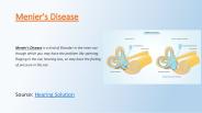 Meniere's Disease