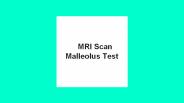Mri scan malleolus test
