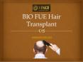 BIO FUE Hair Transplant PowerPoint PPT Presentation