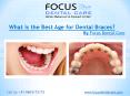 Best Age for Dental Braces | Dental Braces Cost in Hyderabad | Focus Dental Care PowerPoint PPT Presentation