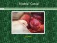 Bladder Cancer PowerPoint PPT Presentation
