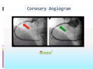 Coronary Angiogram (1)