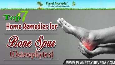 Top 7 Home Remedies for Bone Spur (Osteophytes)