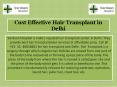 Cost Effective Hair Transplant in Delhi PowerPoint PPT Presentation