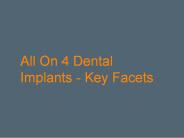 All On 4 Dental Implants - Key Facets