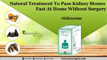 Natural Treatment to Pass Kidney Stones Fast At Home without Surgery