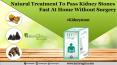 Natural Treatment to Pass Kidney Stones Fast At Home without Surgery PowerPoint PPT Presentation