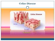 Celiac Disease