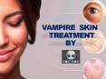 Vampire Skin Treatment PowerPoint PPT Presentation