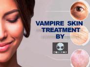Vampire Skin Treatment
