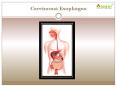 Carcinoma Esophagus PowerPoint PPT Presentation