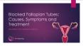Blocked Fallopian Tubes - Symptoms, Causes and Treatment PowerPoint PPT Presentation