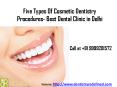 Five Types of Cosmetic Dentistry Procedures- Best Dental Clinic in Delhi PowerPoint PPT Presentation