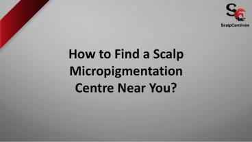 How To Find a Scalp Micropigmentation Centre Near You?