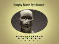 Empty Nose Syndrome PowerPoint PPT Presentation