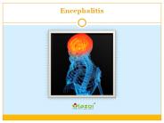 Encephalitis