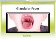 Glandular Fever
