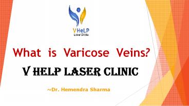 What is Varicose Vien?