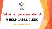 What is Varicose Vien?