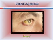Gilbert’s Syndrome