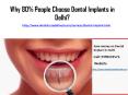 Why 80% People Choose Dental Implants in Delhi? PowerPoint PPT Presentation