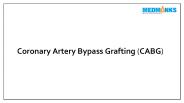 Coronary Artery Bypass Grafting (CABG)