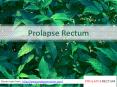 Prolapse Rectum Treatment in India- Prolapserectum.com PowerPoint PPT Presentation
