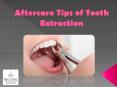 Best Aftercare Tips of Tooth Extraction by Brandon Dentist | Bridges Dental PowerPoint PPT Presentation