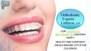 Best Braces in lakewood CO