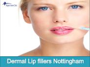 Dermal Lip fillers Nottingham