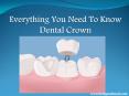 Brandon Dentist: Everything Need To Know About Various Kinds of Dental Crown| Bridges Dental PowerPoint PPT Presentation