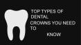TOP TYPES OF DENTAL CROWNS YOU NEED TO KNOW PowerPoint PPT Presentation