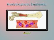 Myelodysplastic Syndromes: Causes, Symptoms, Daignosis, Prevention and Treatment