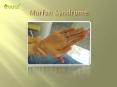 Marfan Syndrome: Causes, Symptoms, Daignosis, Prevention and Treatment PowerPoint PPT Presentation