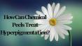 How Can Chemical Peels Treat Hyperpigmentation? PowerPoint PPT Presentation