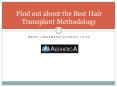 Find out about the best hair transplant methodology PowerPoint PPT Presentation