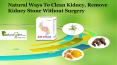 Natural Ways to Clean Kidney, Remove Kidney Stone without Surgery PowerPoint PPT Presentation