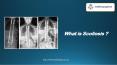Dr Jwalant Mehta - What is Scoliosis? | Best Spinal Surgeons in UK PowerPoint PPT Presentation