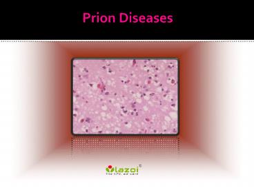 Prion Disease: Causes, Symptoms, Daignosis, Prevention and Treatment