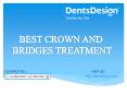 Best Dental Crown and Bridges Treatment in Pune PowerPoint PPT Presentation