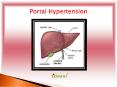 Portal Hypertension: Causes, Symptoms, Daignosis, Prevention and Treatment PowerPoint PPT Presentation