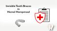 Invisible Teeth Braces in Hemel Hempstead PowerPoint PPT Presentation