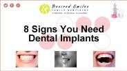 8 Warning Signs You Need Dental Implants Today