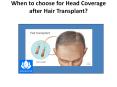 Best Hair Transplant Clinic In Bhubaneswar  gives good service PowerPoint PPT Presentation