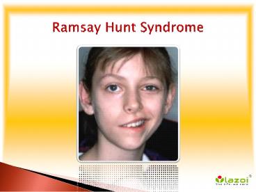 Ramsay Hunt Syndrome: Causes, Symptoms, Daignosis, Prevention and Treatment
