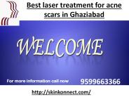 Best Treatment for Acne Scars