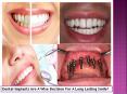 Dental Implants Are A Wise Decision For A Long Lasting Smile! PowerPoint PPT Presentation