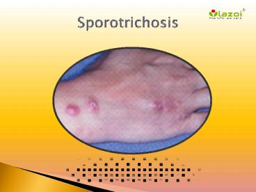 Sporotrichosis: Causes, Symptoms, Daignosis, Prevention and Treatment