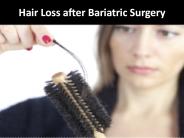 Hair Loss after Bariatric Surgery
