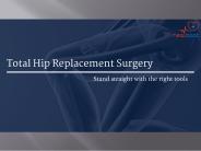 Know all About Hip Replacement Surgery in India